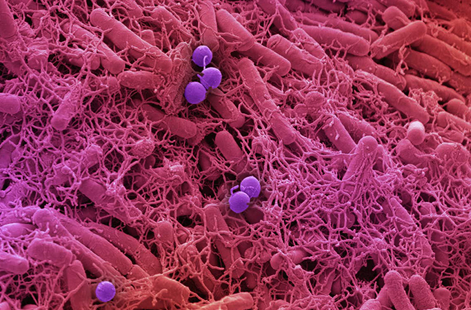 Микробы на коже